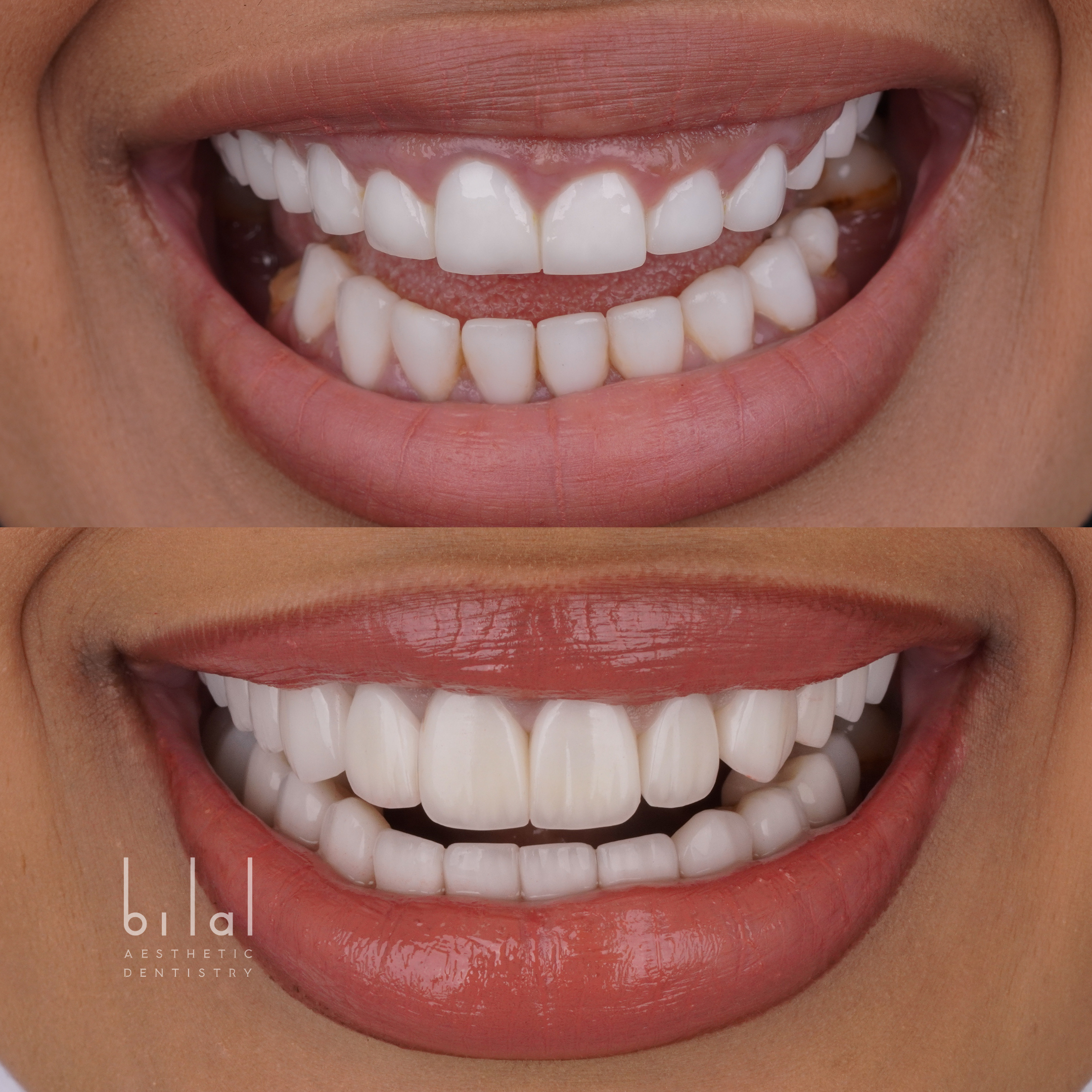 Untitled design.zip - 3.PNG