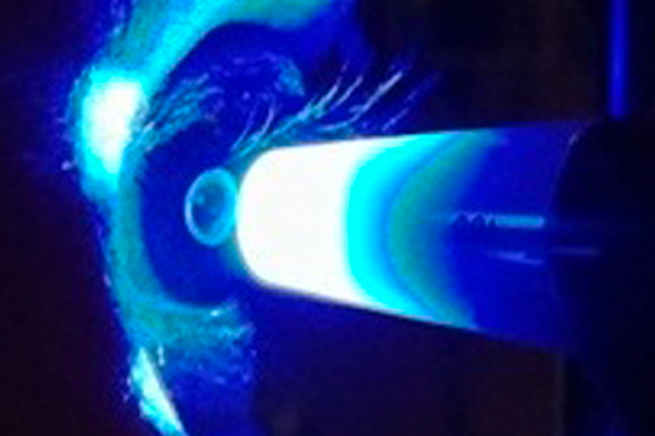Goldmann Applanation Tonometry 2.png