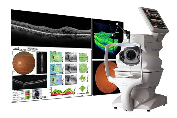 OCT eye scan at Underwood Eyecare