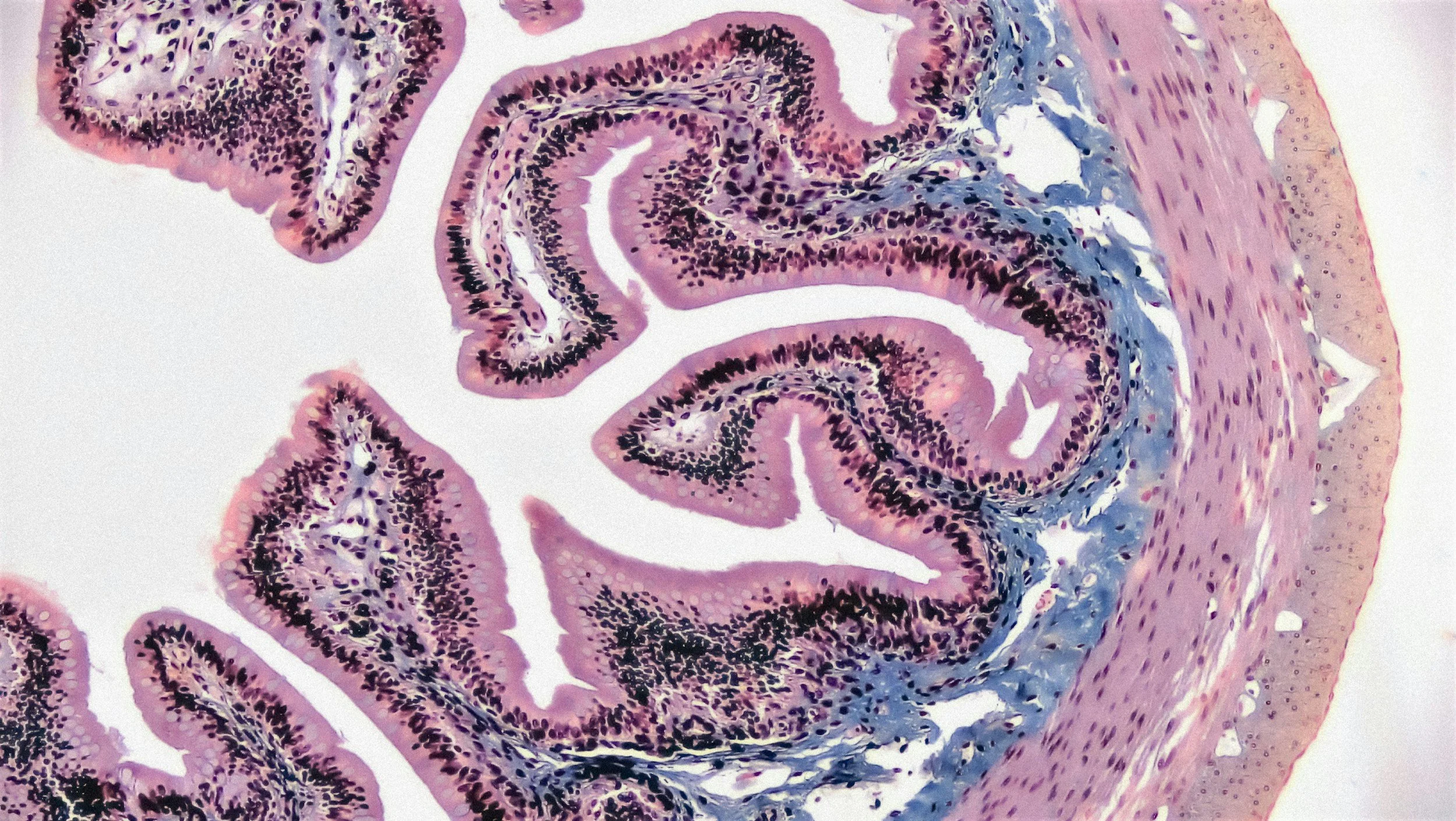 GUT HEALTH