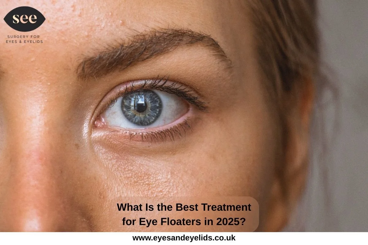 Best Treatment for Eye Floaters