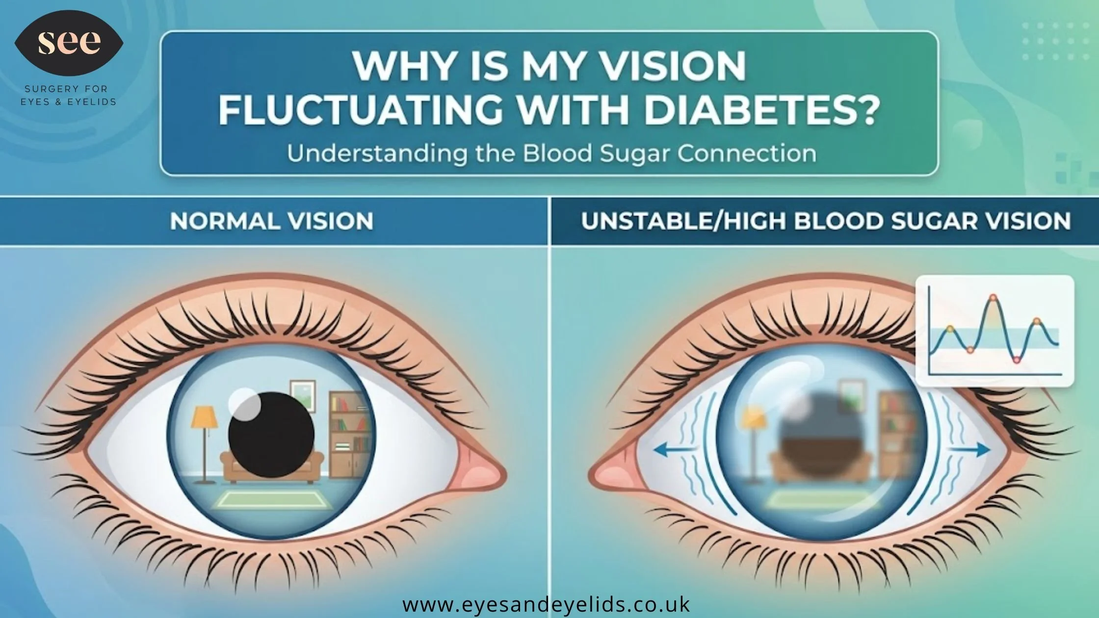 fluctuating vision diabetes