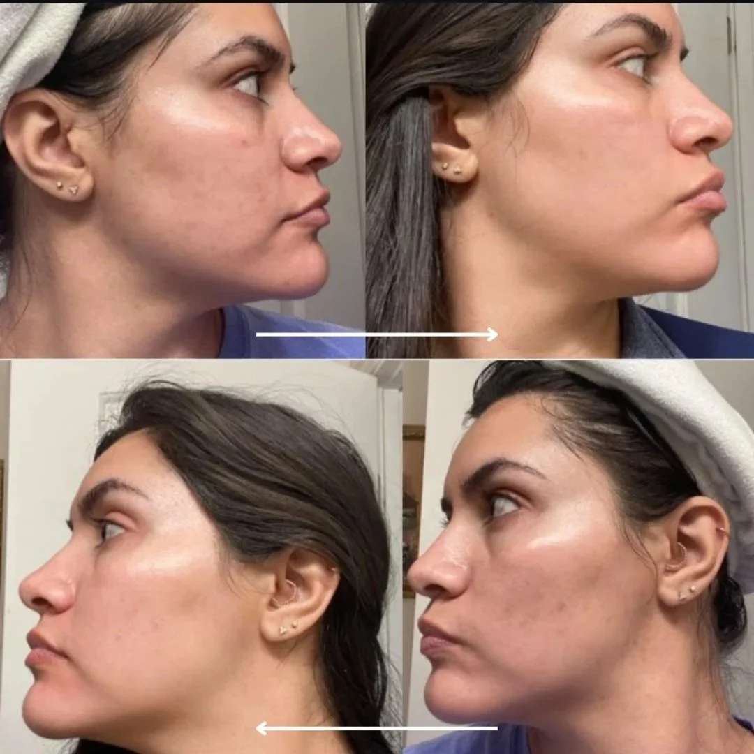 1 Lighten & Brighten 