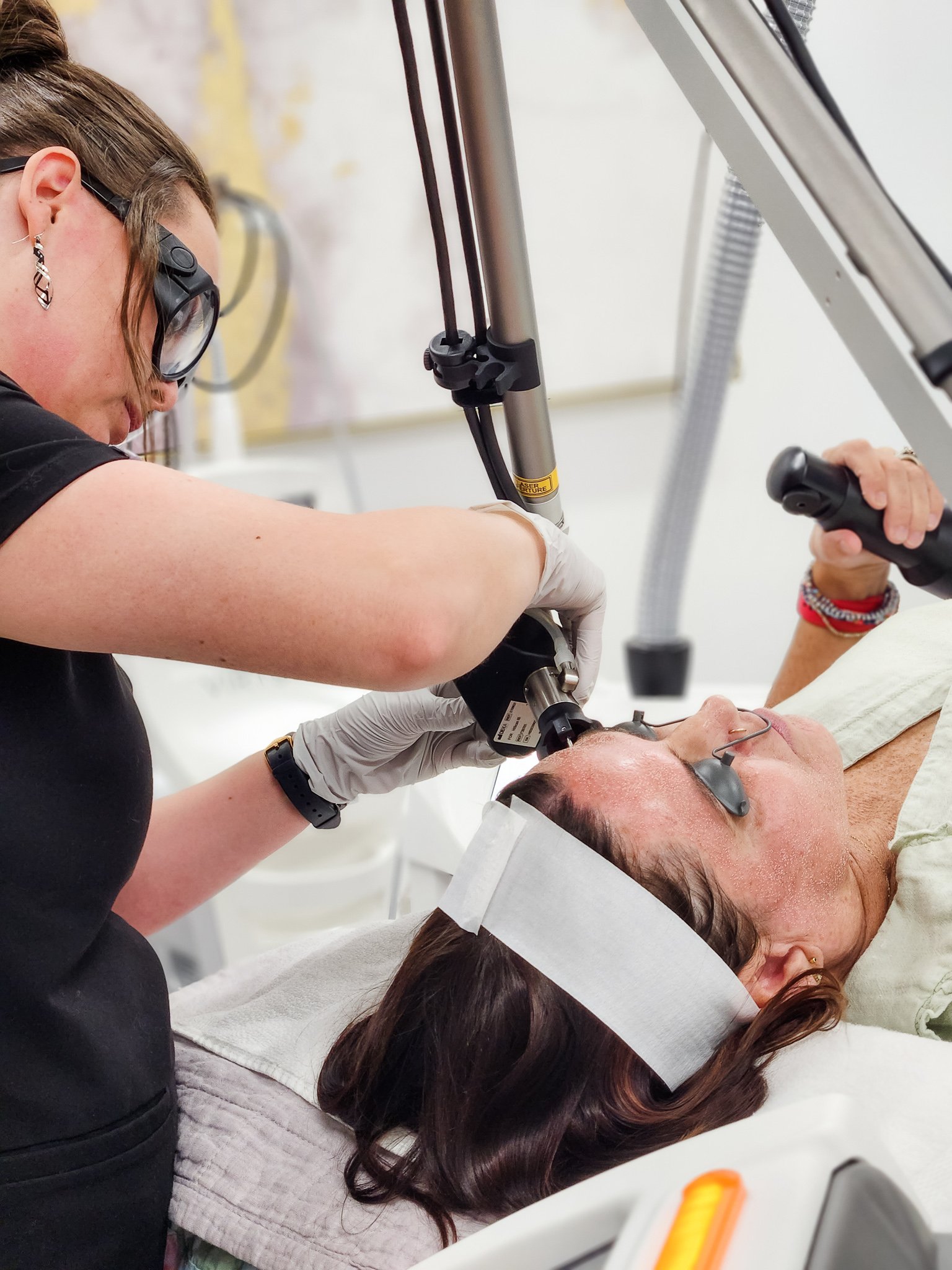 CoolPeel vs. DEKA Peel: Which CO2 Laser Do You Actually Need?