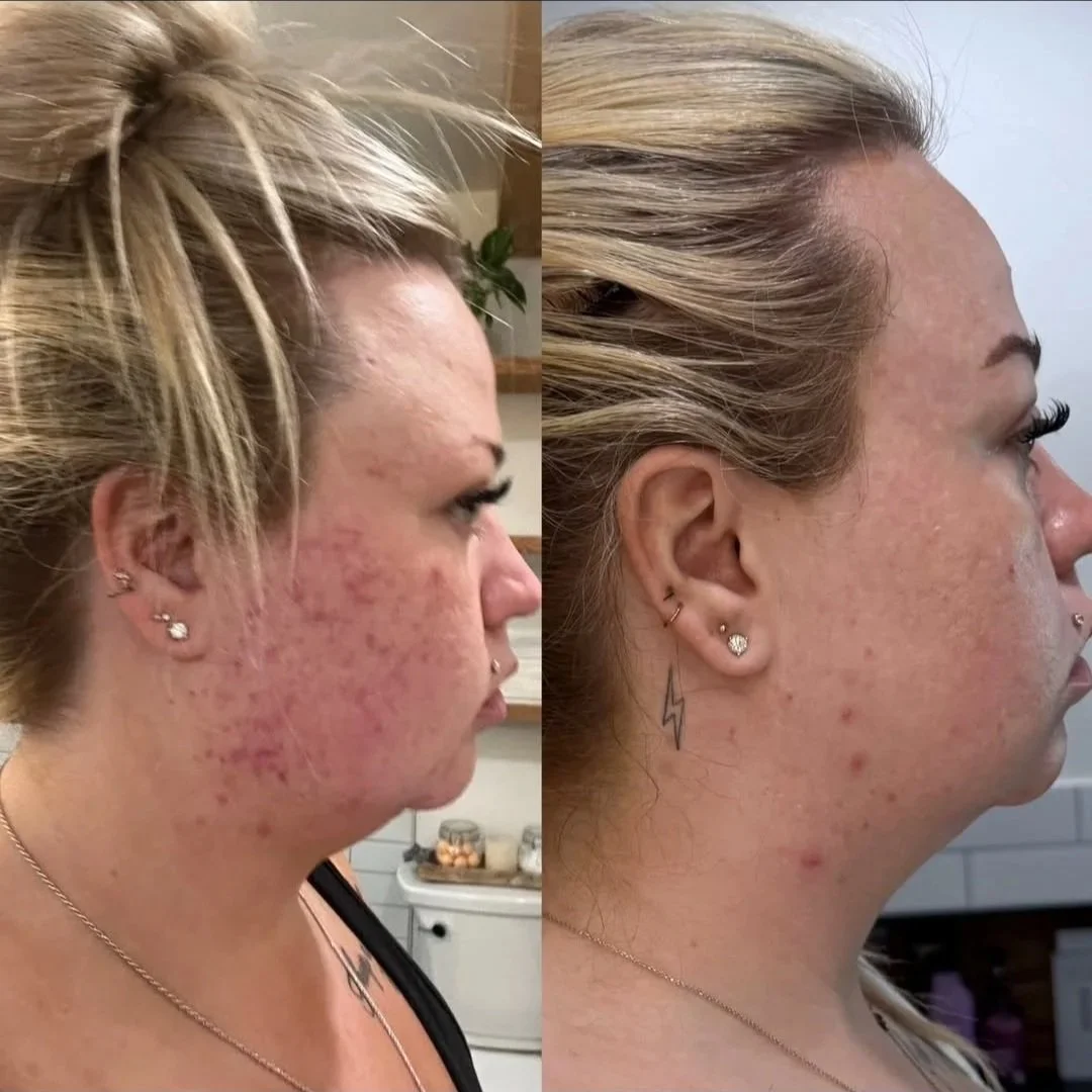 Before and after — The Ultimate Duo