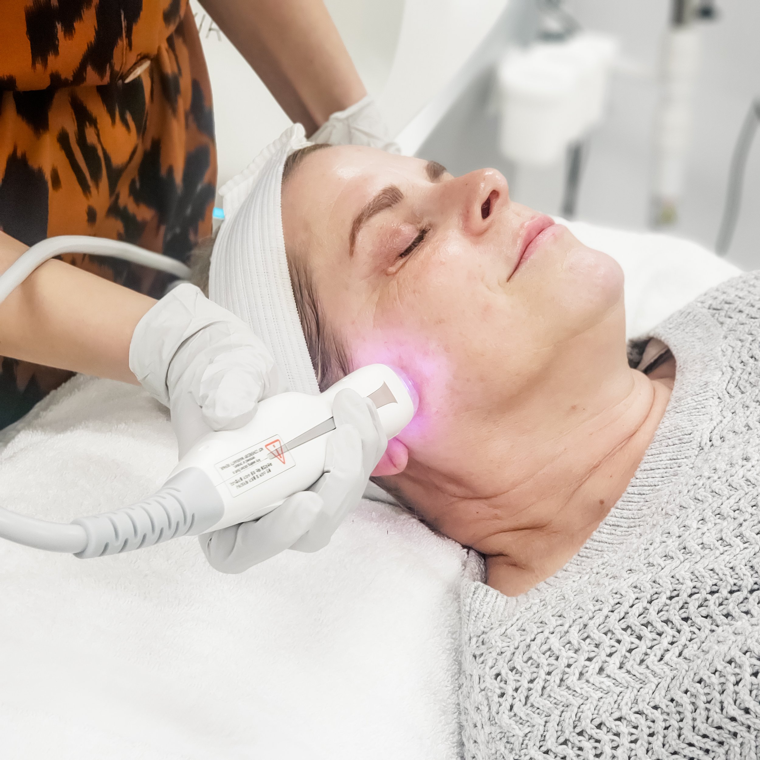 The Ultimate Duo, Cartessa, Skin Tightening, Deka Laser, Cool Peel, Skin Resurfacing, CO2 Laser