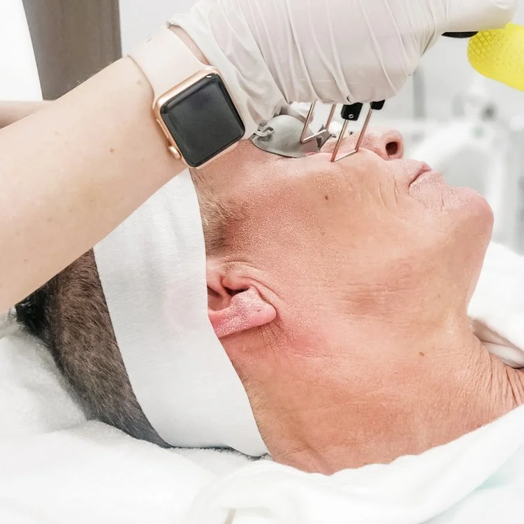 cool peel, co2 laser, skin rejuvenation treatment, laser skin rejuvenation