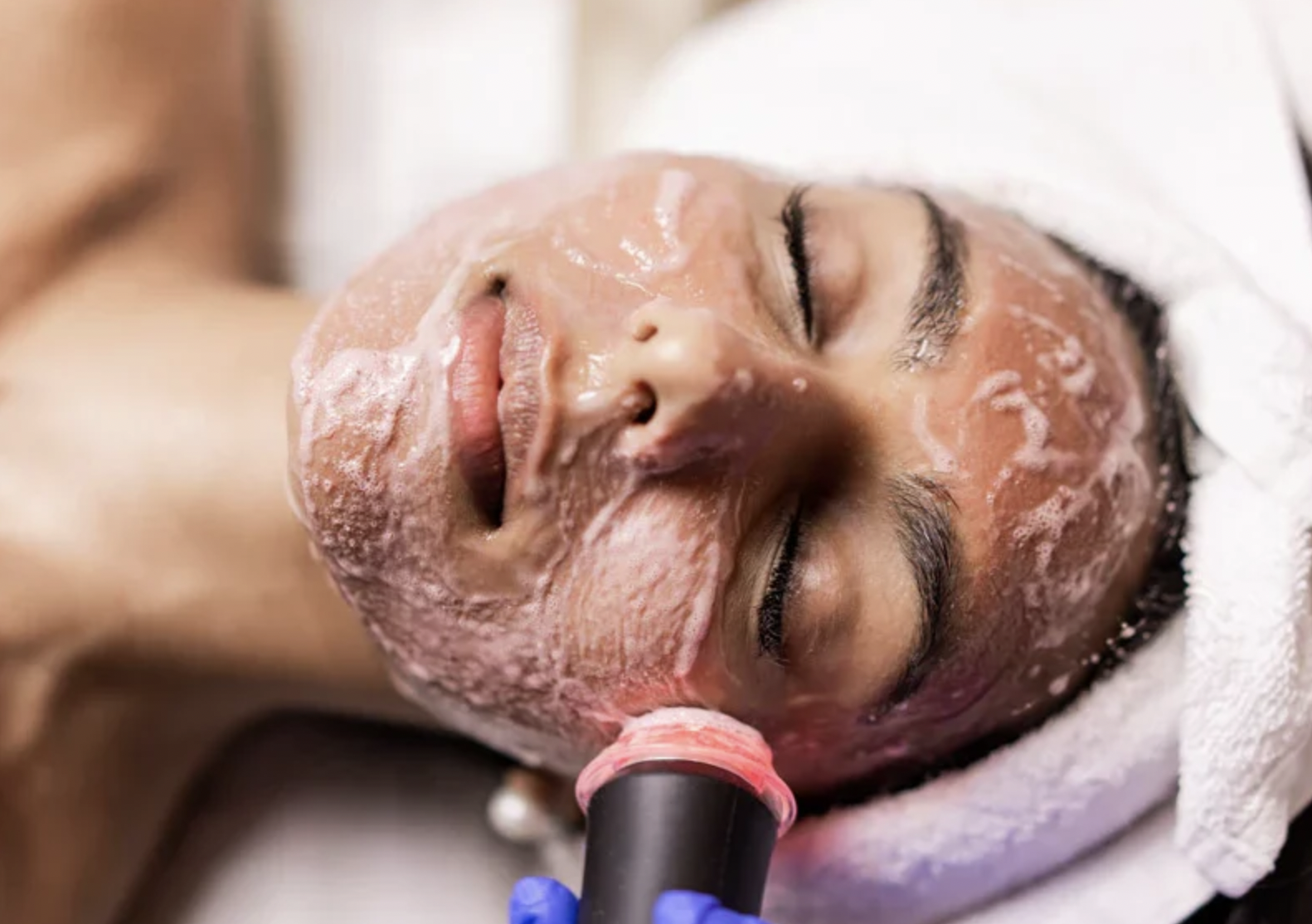 Bye Bye Blemishes Facial