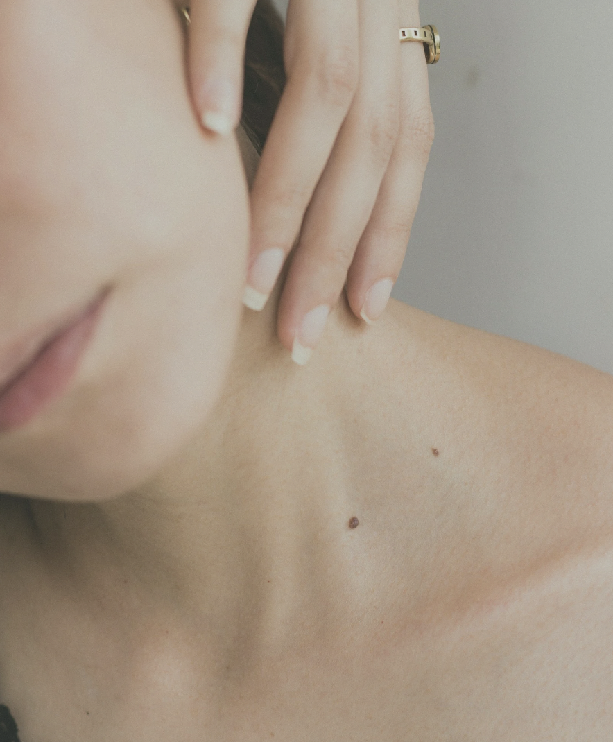 loss of firmness, loose skin, skin tightening, morpheus, rf microneedling, cool peel, deka peel. co2 laser, resurfacing