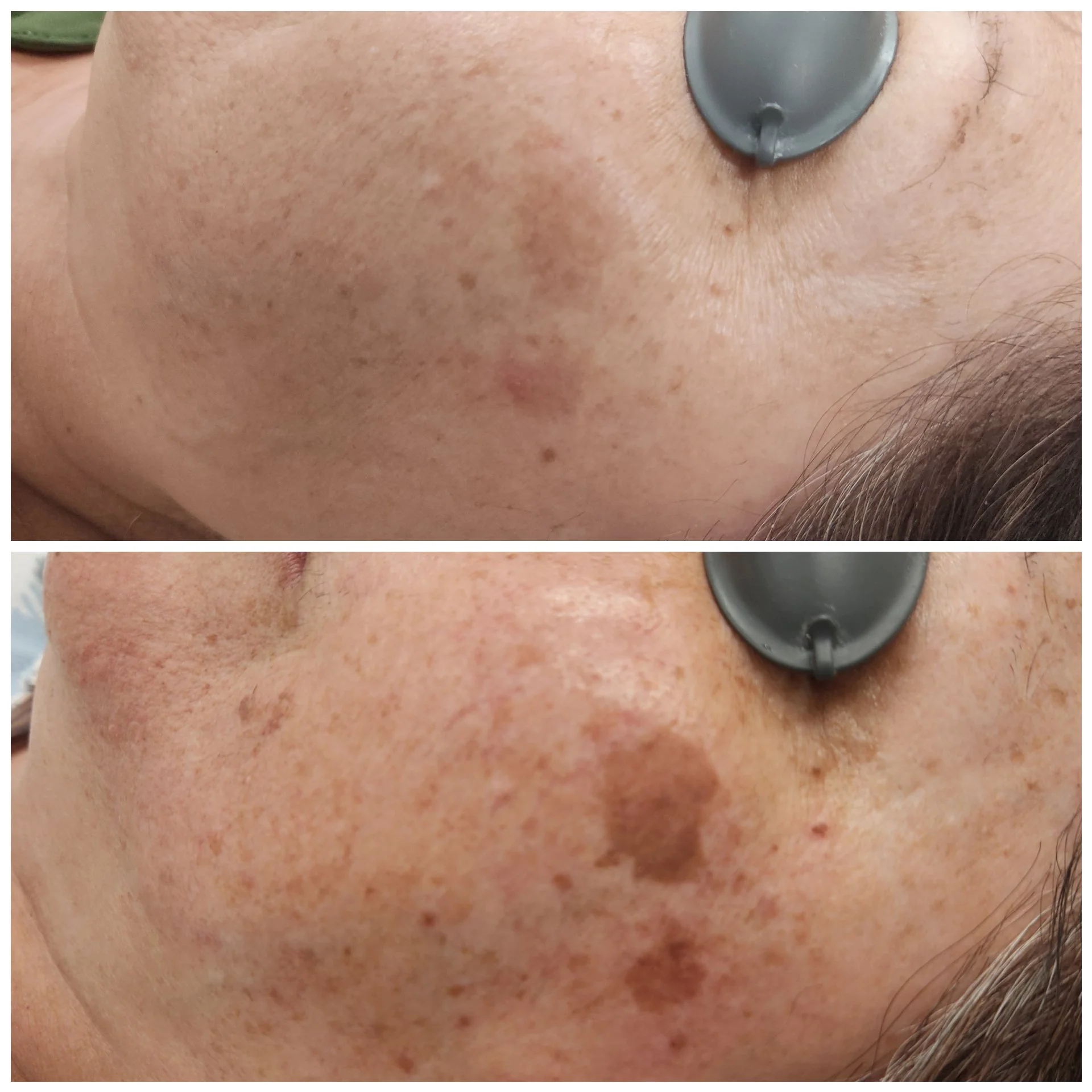 Lighten & Brighten Me