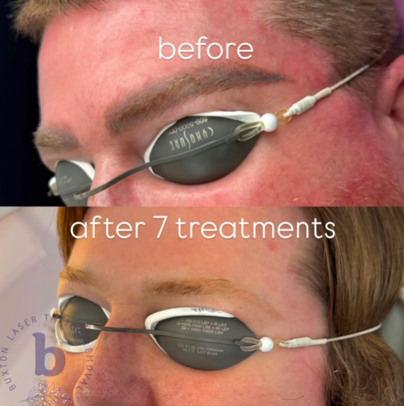 Screen Shot 2026-03-17 at 11.22.45 am.png