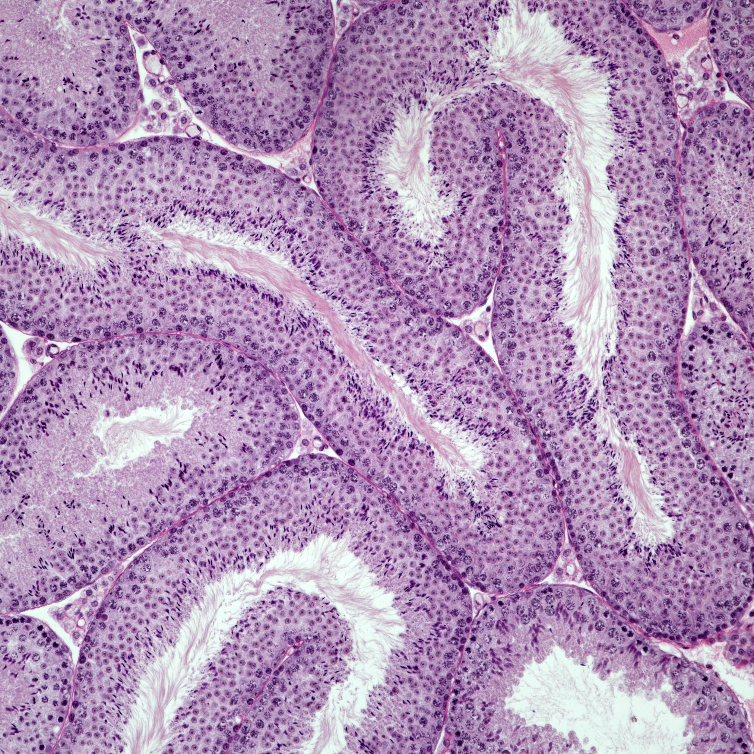4309B_MeiocHet_Hspa2Het_HePAS_sec3_20x050-Focused Images_RGBedited.png
