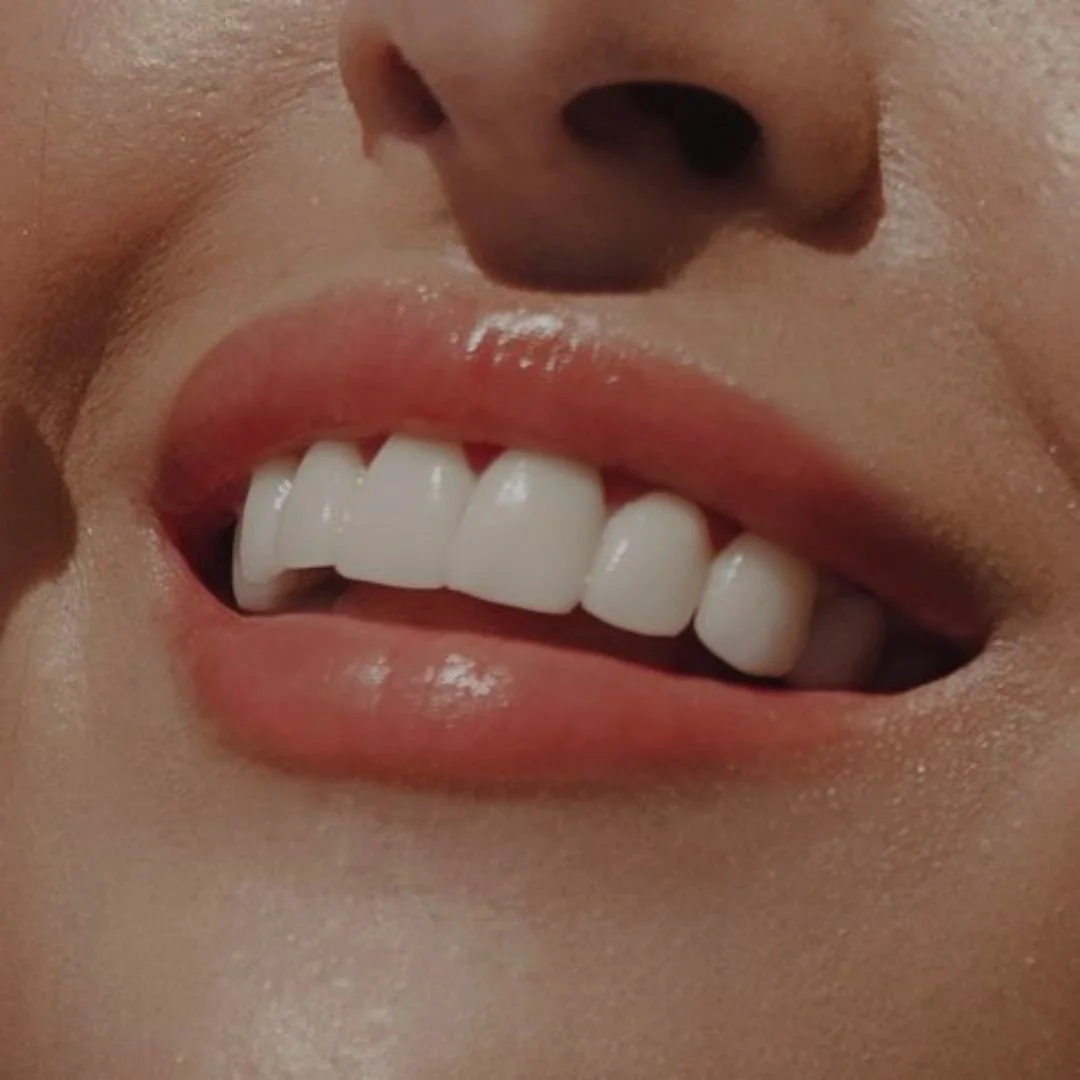 A close-up of someone's smiling mouth, with teeth showing that are bright, white, and a result of Flirt Custom Lash Studio Toronto's LED Blue Light Teeth Whitening service, at an affordable cost.