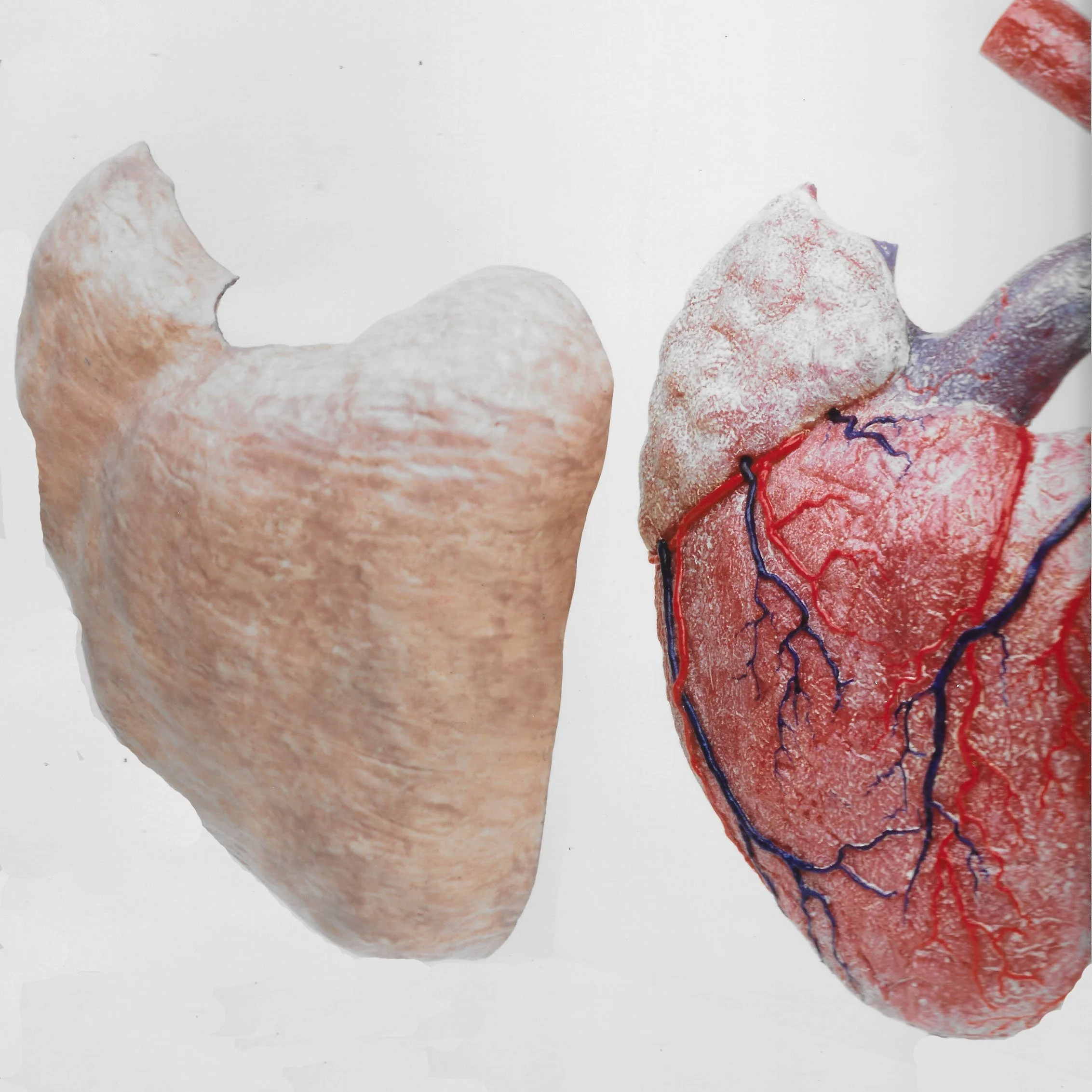 Anatomical — Graham High