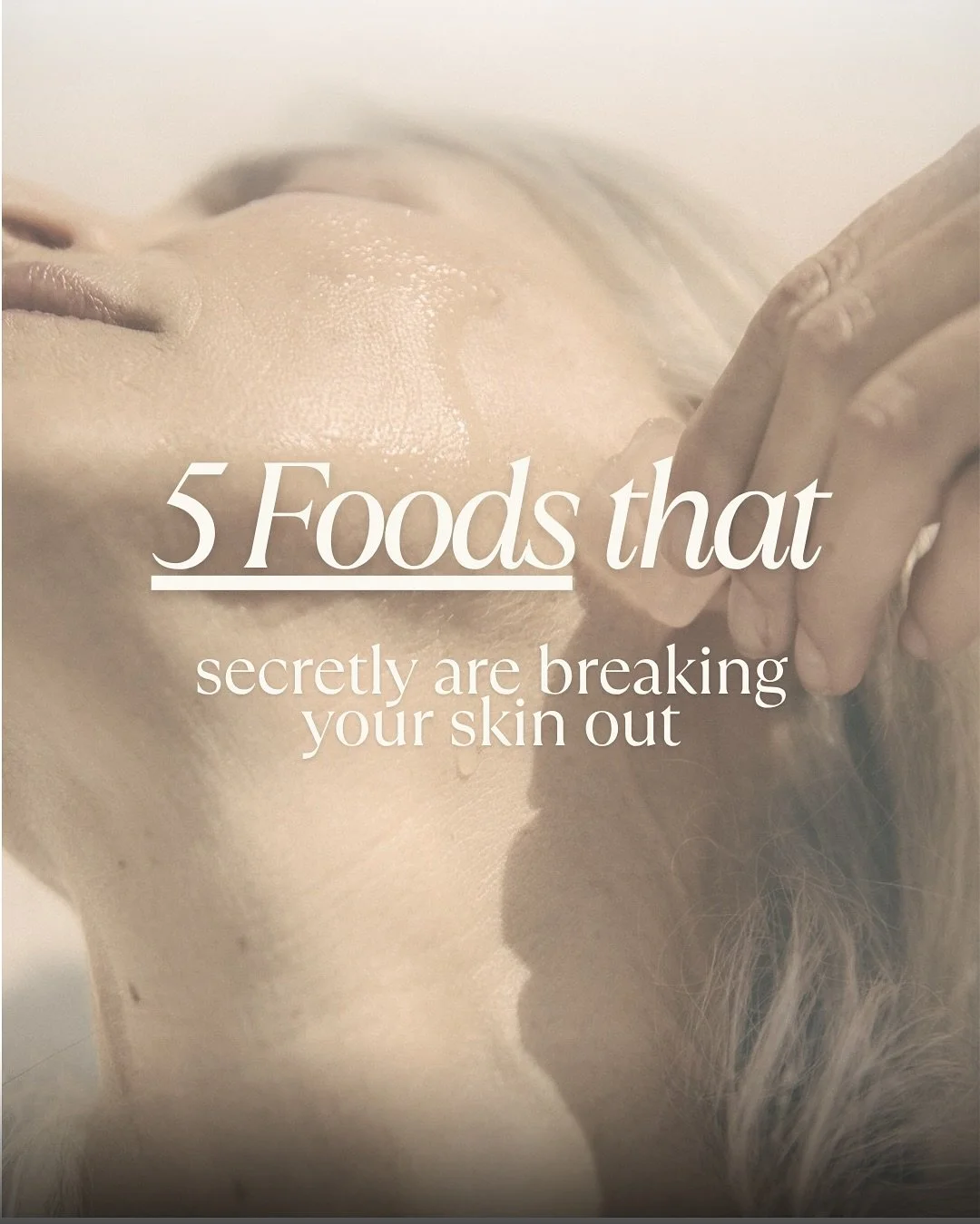 What you eat can show up on your skin. 🍽️✨
Here are 5 common foods and drinks that may be secretly contributing to breakouts:
🥛 Dairy products
🍔 Fried &amp; fast foods
🍬 Sugary snacks &amp; drinks
🍷 Alcohol
🥖 Refined carbs

These can increase i