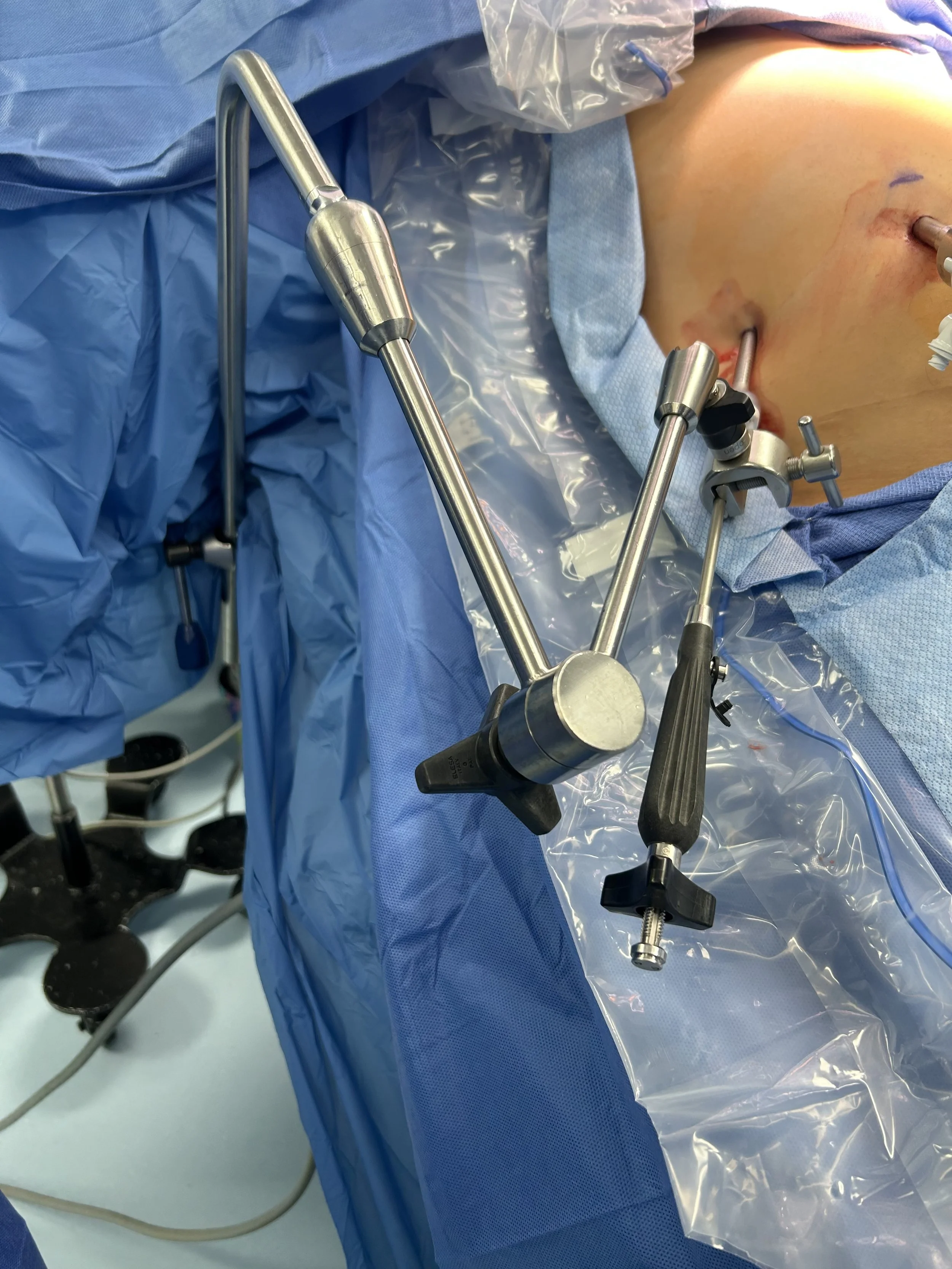 When surgical tools aren’t available, get creative