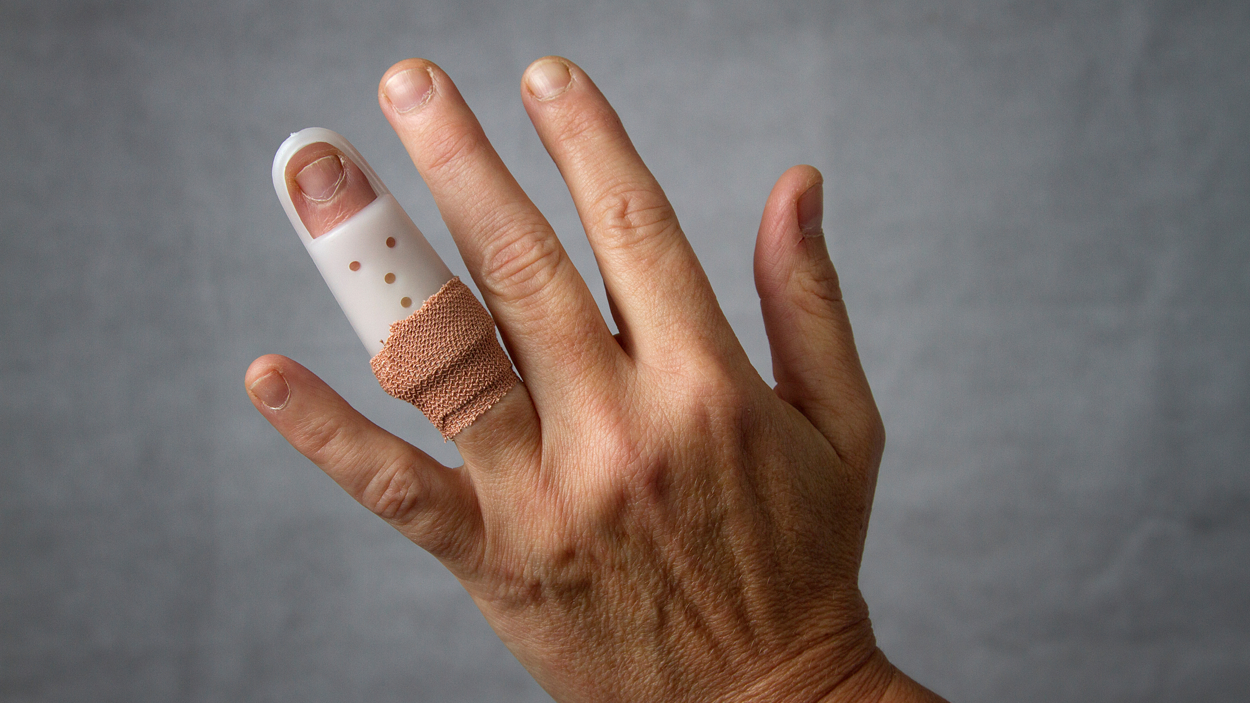 I Broke My Finger. Does It Need Surgery?