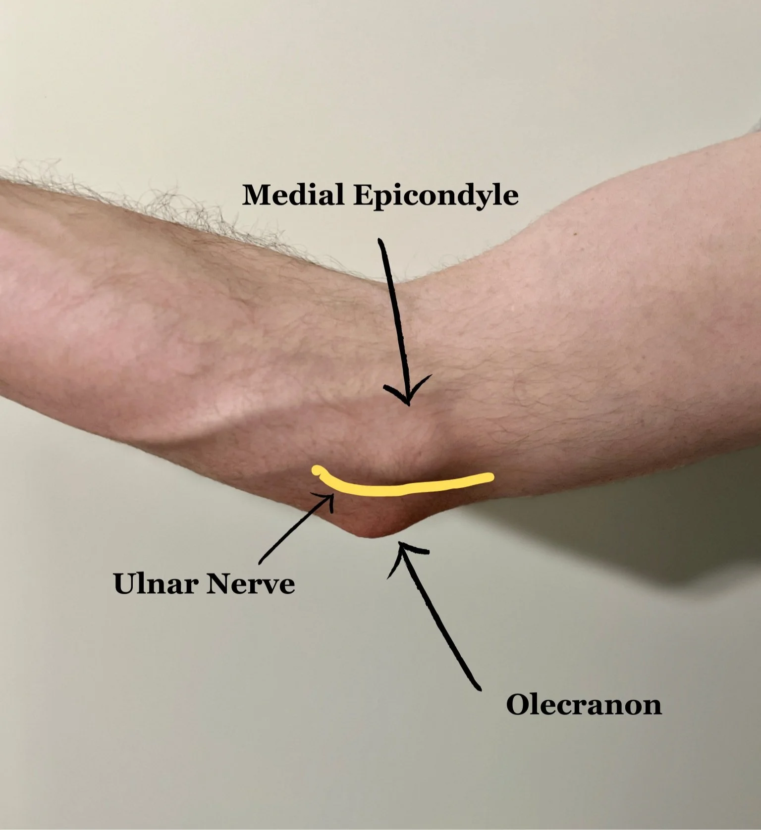 Olecranon Process Ulnar Nerve