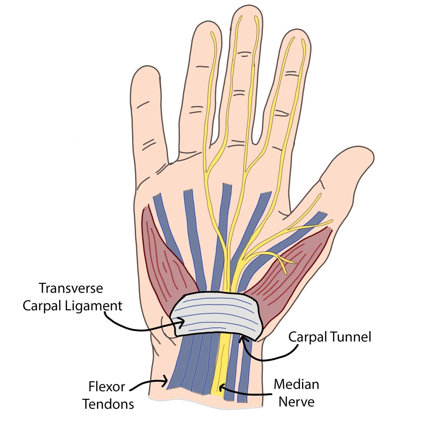 Carpal Tunnel Syndrome Denver Colorado Dr Nick Golinvaux Carpal Tunnel Syndrome Denver Colorado Dr Nick Golinvaux