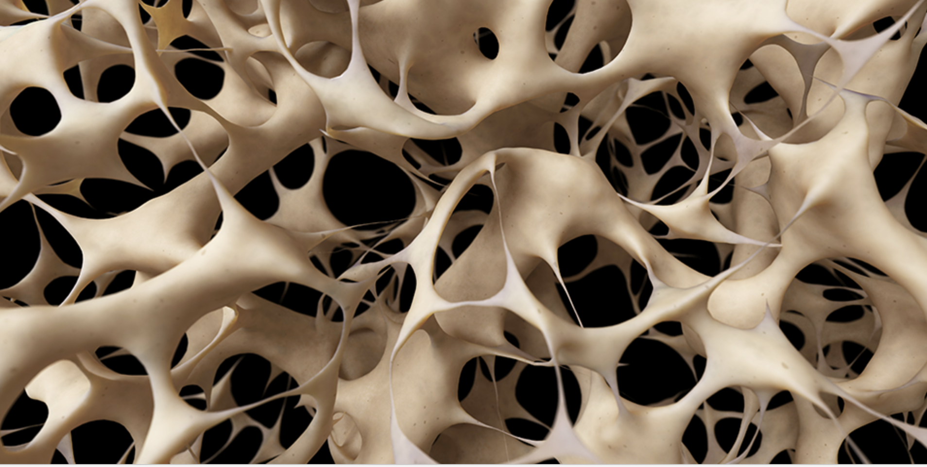 TEACHER's WORKSHOP JUNE 2026: Osteoporosis and Osteopenia. What to know and what to do with Pilates