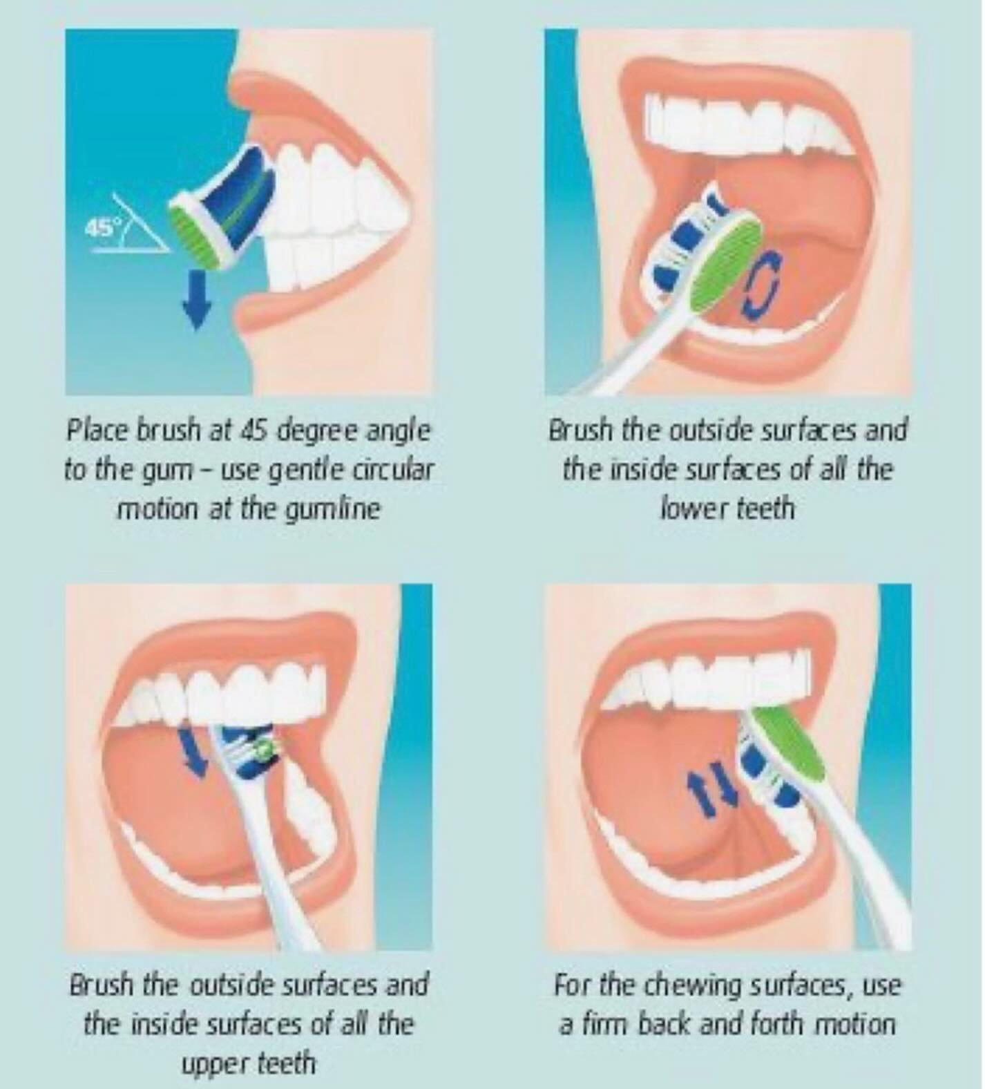 👉🏽Your Monday reminder that it&rsquo;s important to brush like this EVERY time you brush&hellip;not just on the day you come to your biannual cleaning with us! 😄 🤭🦷🪥

Repost&hellip; thank you! @dr.paoladrl 

#dentist #dentistlife #brushyourteet