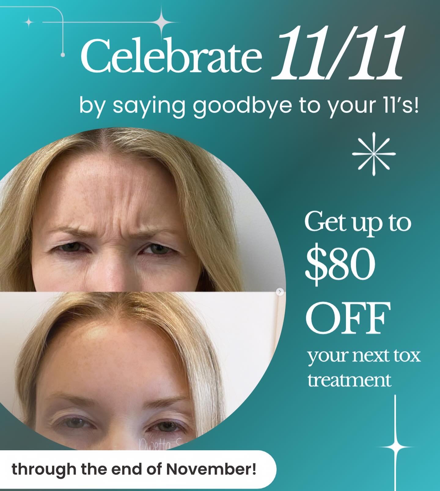 🎉 Happy 11/11! We are celebrating Elevens Day with a deal to save up to $80 Off on your next tox treatment✨👏 Reserve your spot and get all the deets&hellip;call us! 
📞 440-247-5117