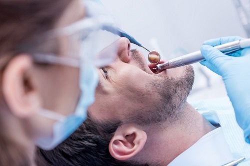 Dental Sealants