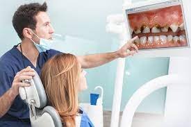 Oral Cancer