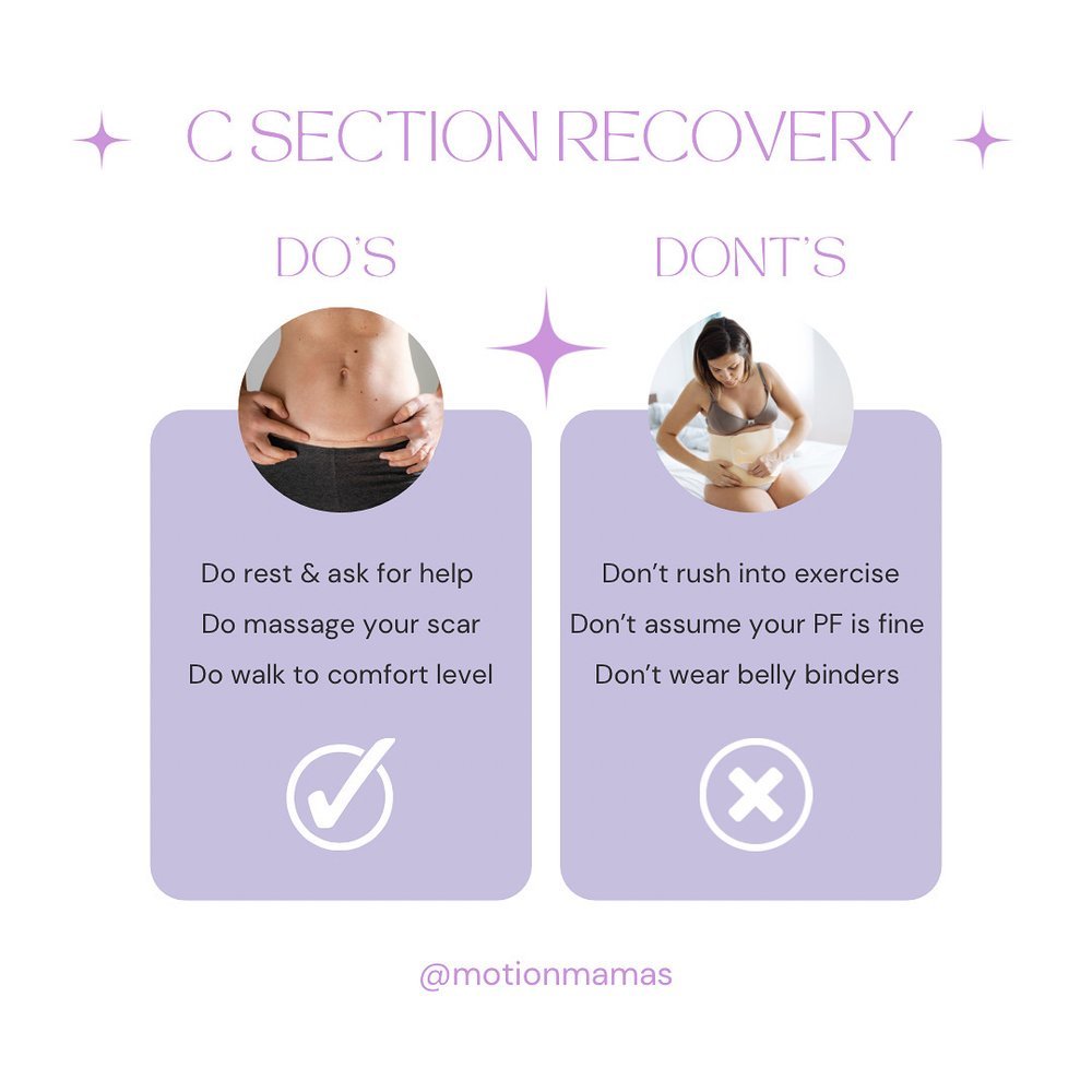 C-Section Q&A: The Facts and What it Takes to Recover