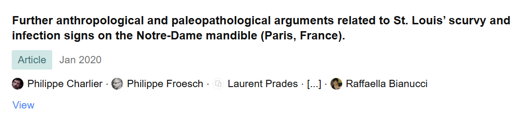 Screenshot of an academic article titled 'Further anthropological and paleopathological arguments related to St. Louis’ scurvy and infection signs on the Notre-Dame mandible in Paris, France,' published January 2020, with authors Philippe Charlier, Philippe Froesch, Laurent Prades, and Raffaella Bianucci.