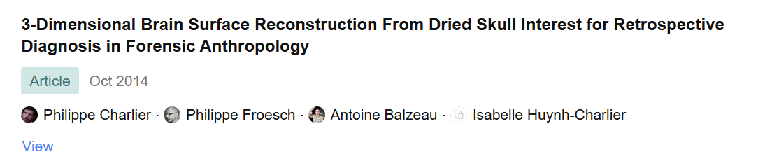 Screenshot of a scientific article titled "3-Dimensional Brain Surface Reconstruction From Dried Skull Interest for Retrospective Diagnosis in Forensic Anthropology" from October 2014, along with author names Philippe Charlier, Philippe Froesch, Antoine Balzeau, and Isabelle Huynh-Charlier.