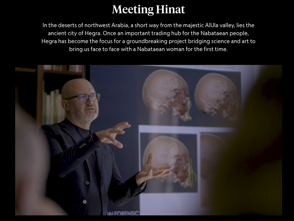 A man with glasses and a beard gestures while speaking in front of a forensic facial reconstruction presentation slide showing brain scans.