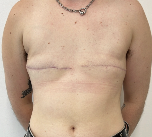 Gender Affirmation Surgery