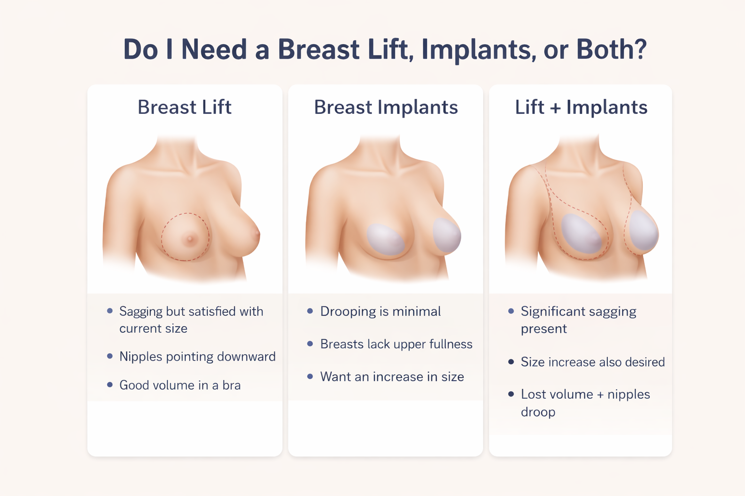 Do I Need a Breast Lift, Implants, or Both?