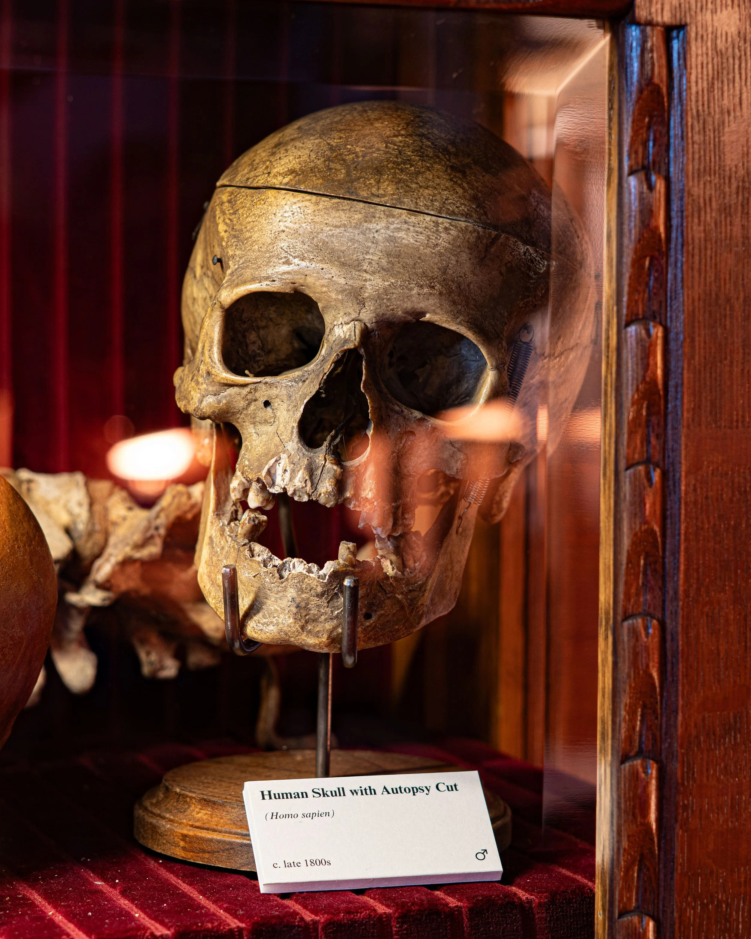 Real human skull
