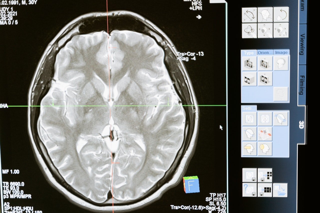 23. Where does ADHD come from?