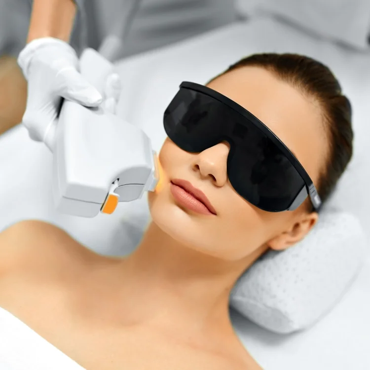 ICON™ IPL Laser Treatment