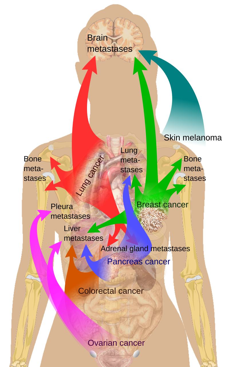 Adrenal Tumours
