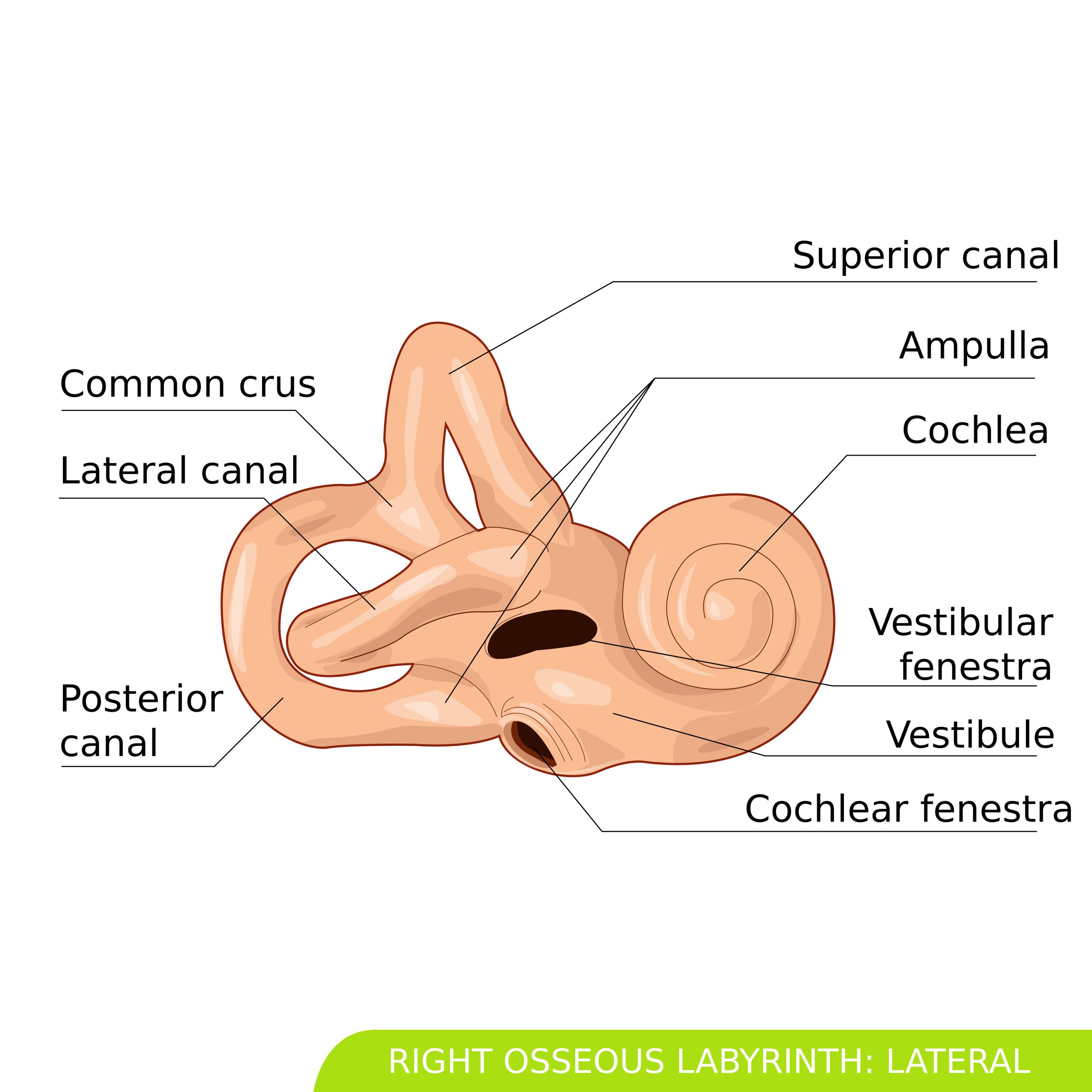 Labyrinthitis