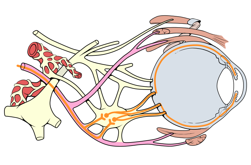 Third-nerve palsy