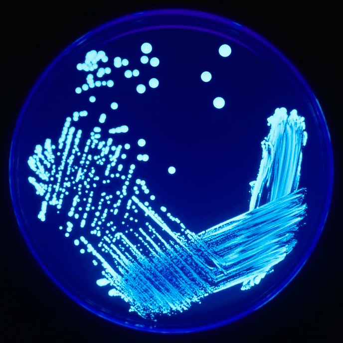Legionella (Legionnaires' Disease)