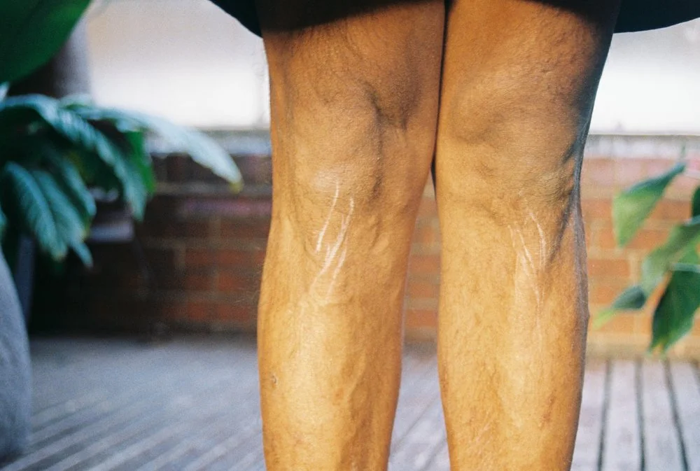 everyday-exotic-scratched-knees.jpg.jpg