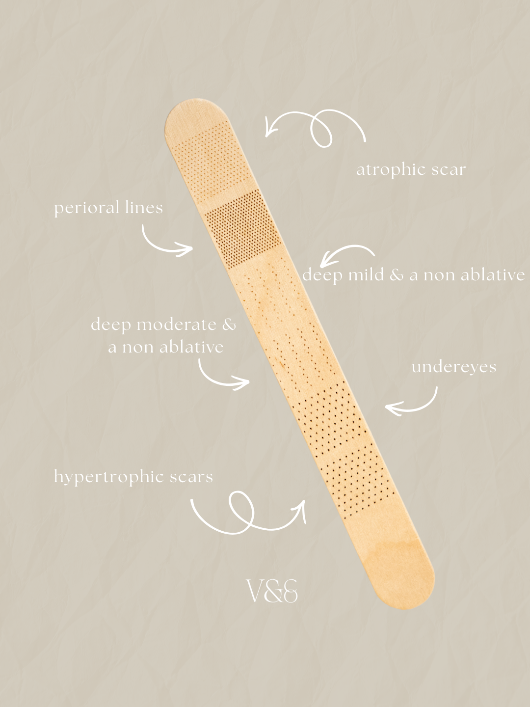 CoolPeel vs. CoolPeel Fusion: Which Laser Resurfacing Treatment Is Right for You?