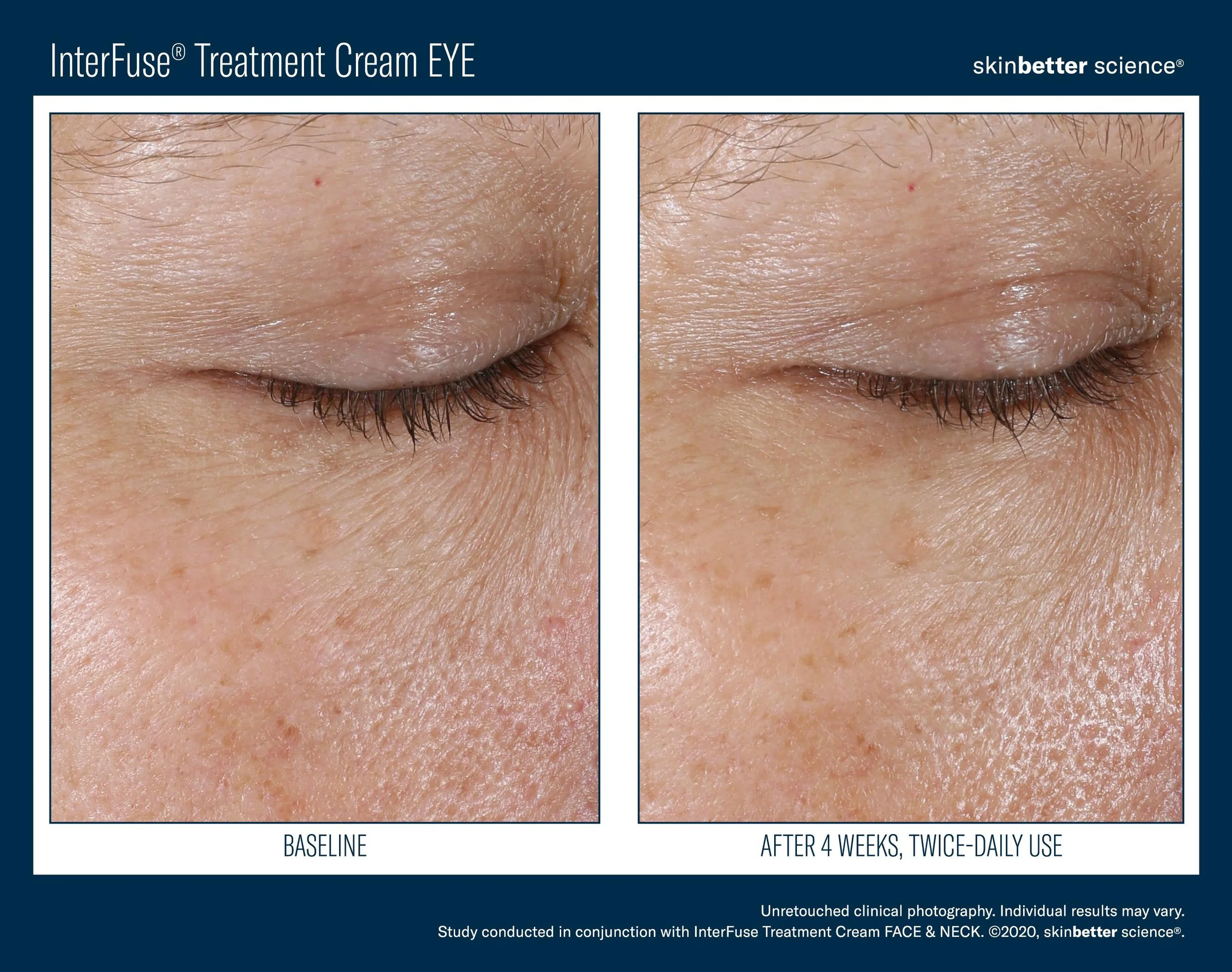 InterFuse EYE Before _ After Template-6.jpg