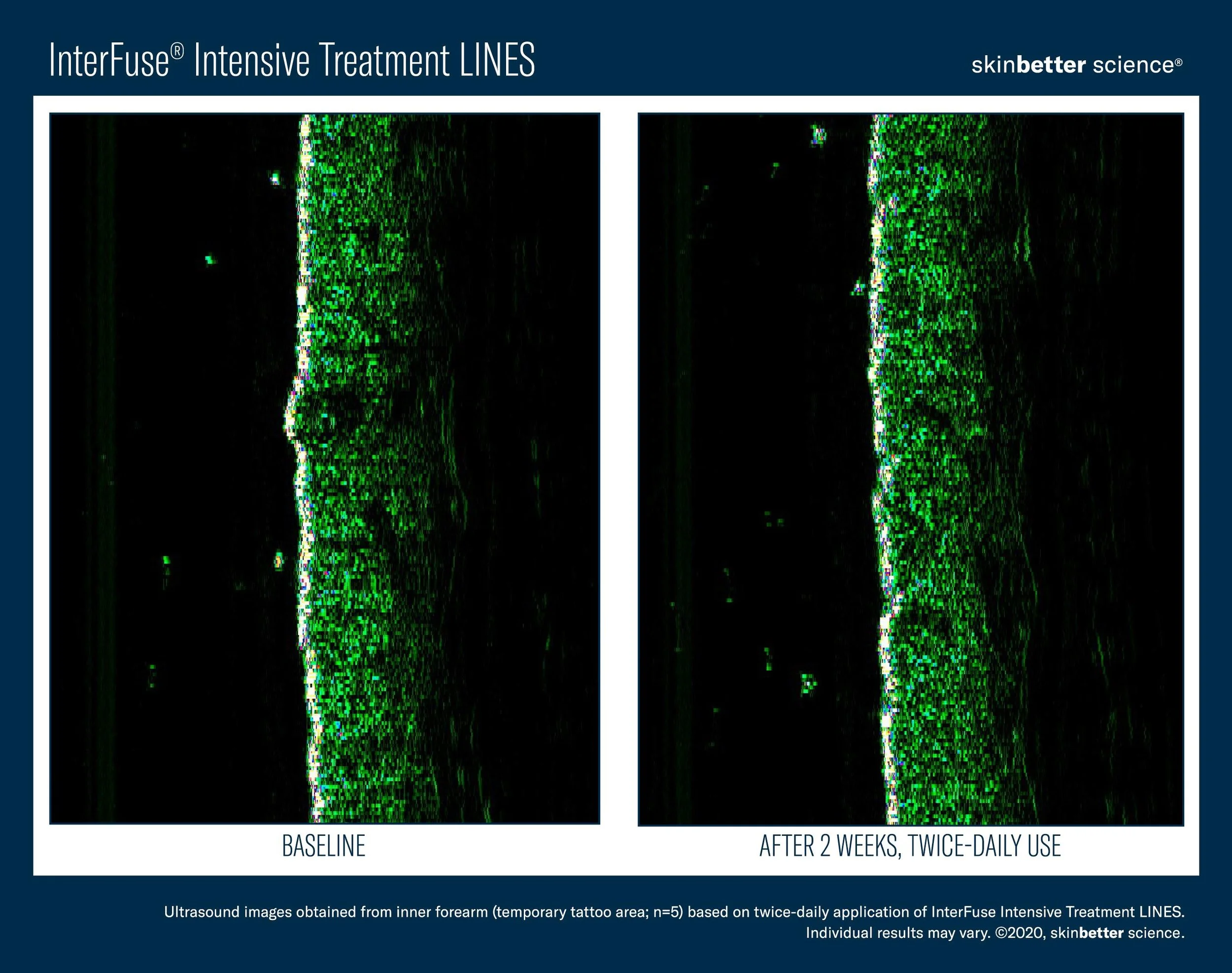 InterFuse LINES Before _ After Template-2.jpg