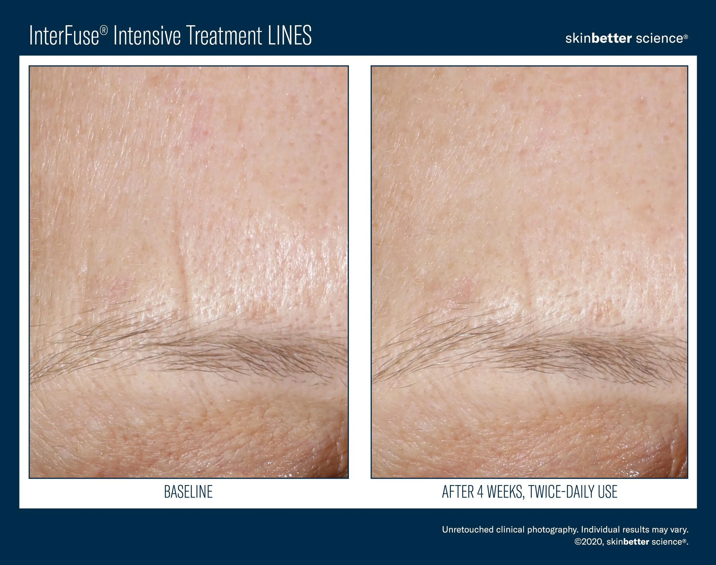 InterFuse LINES Before _ After Template-3.jpg