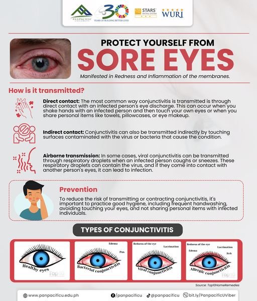 SORE EYES AWARENESS