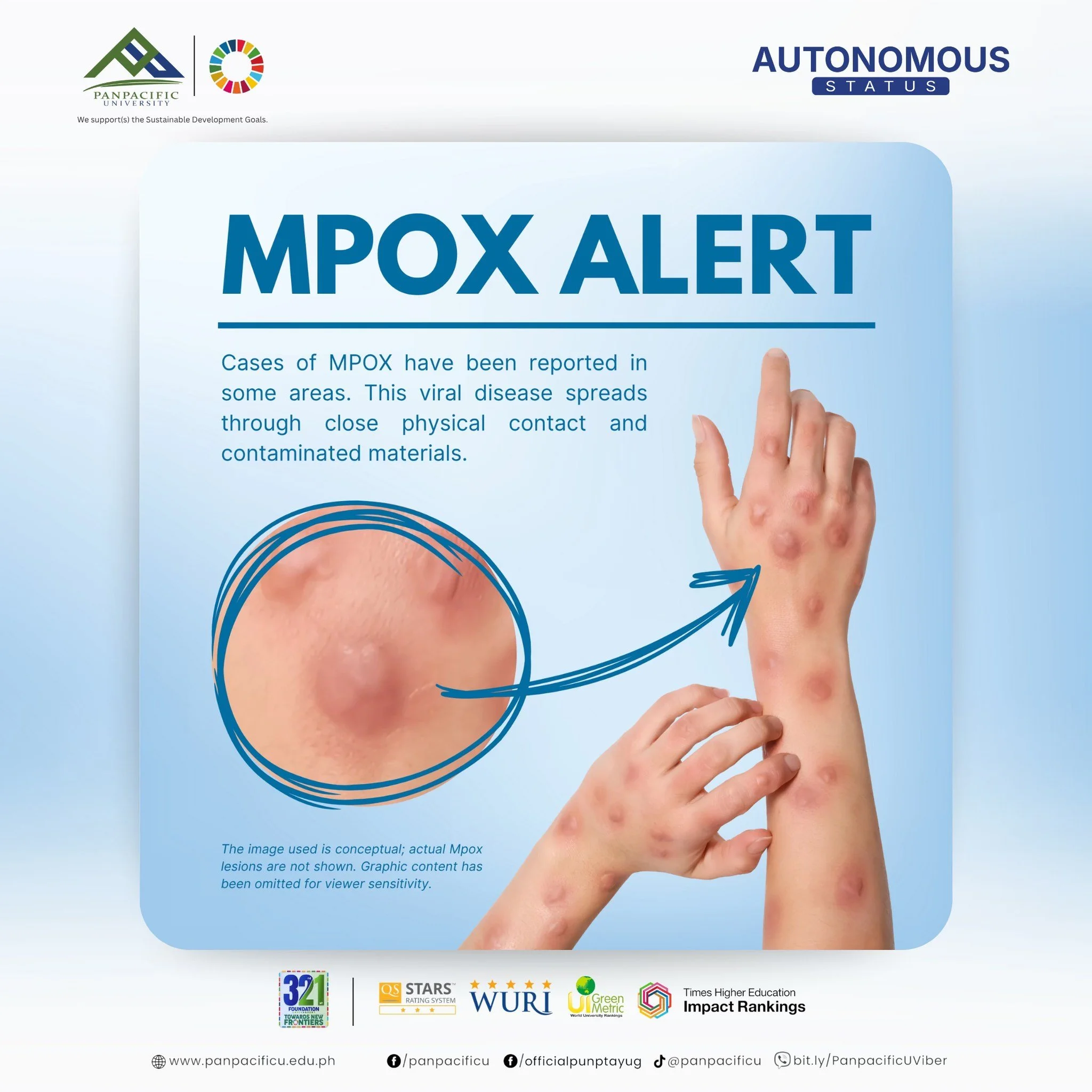 [MPOX] [ALERT]