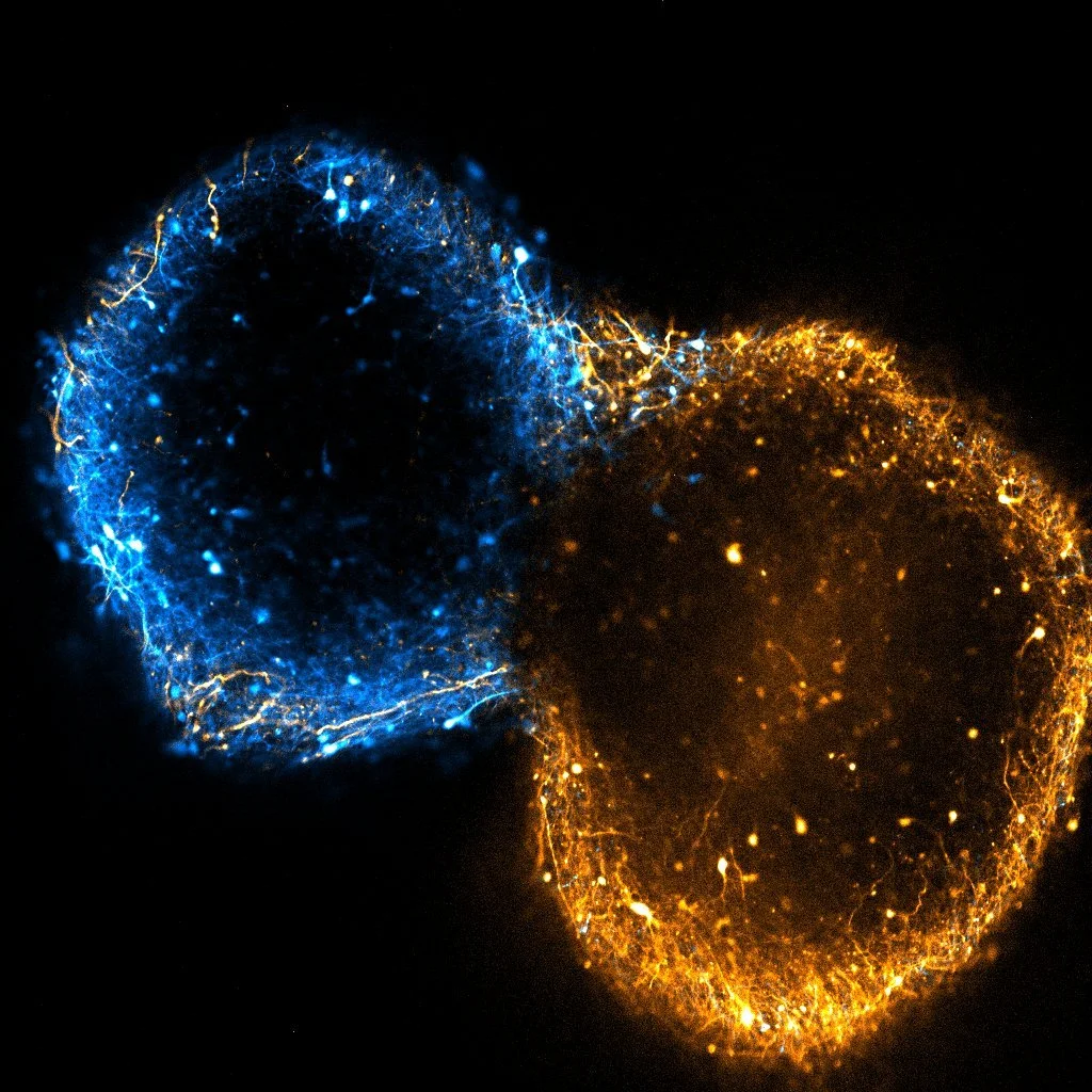 HCO–DRN assembloid, day 97. Fluorescence microscopy from the Revah Lab.