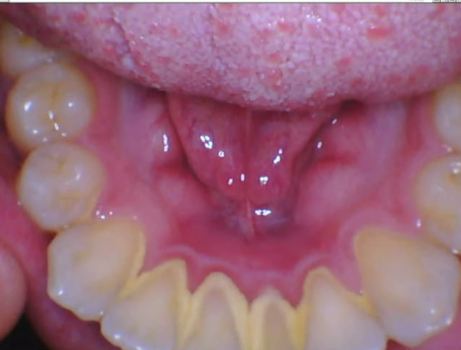 Eric Heim Dental — cleaning, adult prophylaxis, perio maintenance